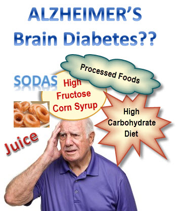 Alzheimer's Disease - Brain Diabetes - Type 3 Diabetes